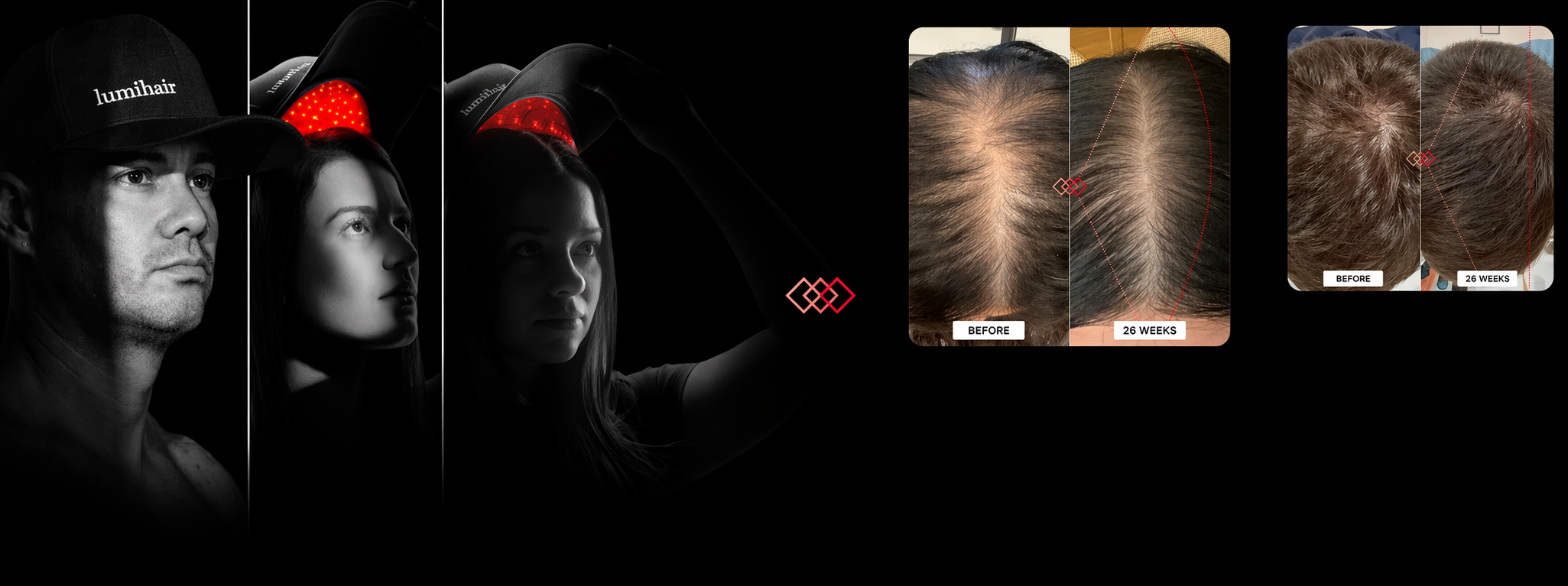 LumiHair Pro